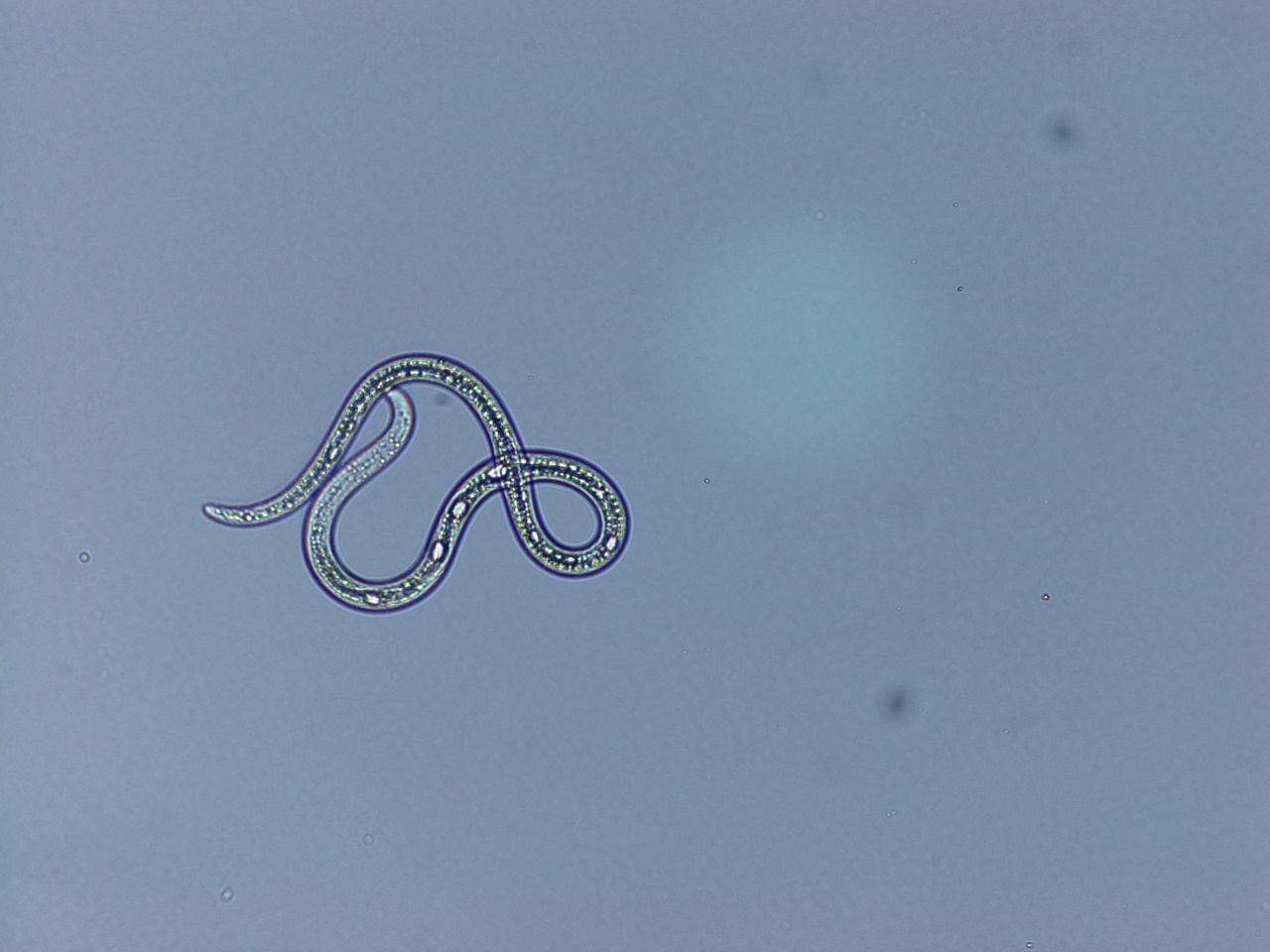 Tallvedsnematoden är en rundmask som är mindre än en millimeter lång.